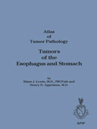 Tumors of the Esophagus and Stomach. Atlas of Tumor Pathology