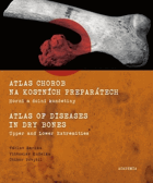 Atlas chorob na kostních preparátech - horní a dolní končetiny. Atlas of diseases in dry bones