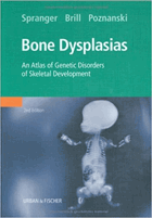 Bone Dysplasias