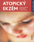 Atopický ekzém