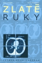 Zlaté ruky. Pribeh Bena Carsona